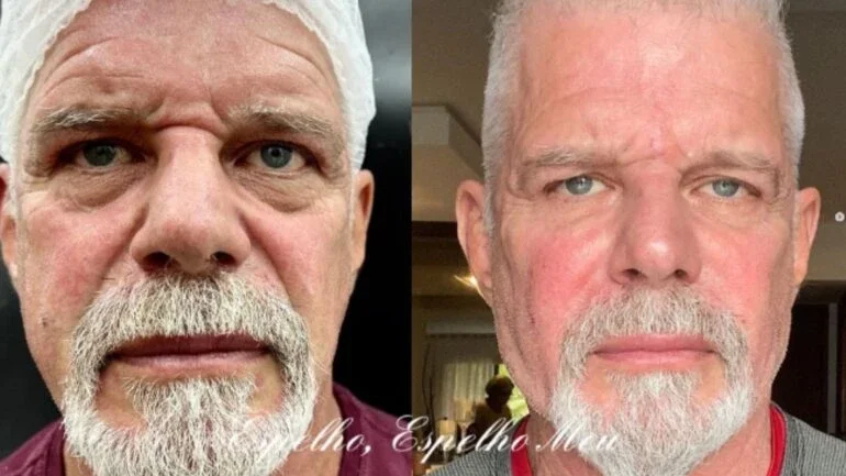 raul gazolla