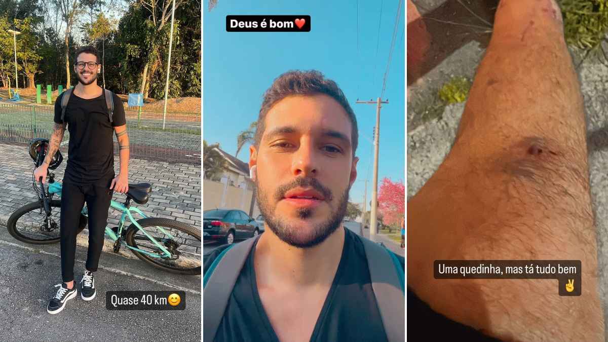 Rodrigo Mussi sofre acidente de bike e rala o joelho: 'Uma quedinha, mas tá tudo bem'