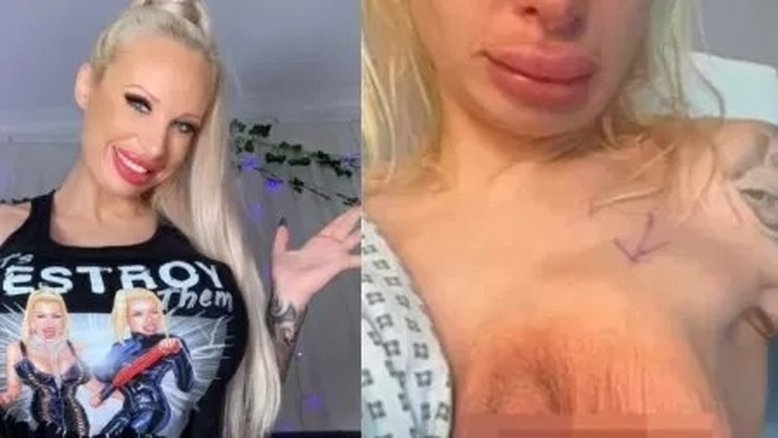 Vídeo: Atriz mostra seio após prótese de silicone estourar e choca seguidores