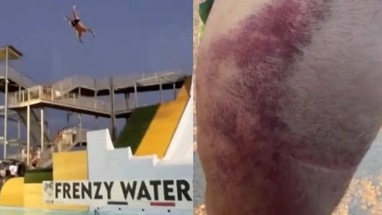 Vídeo: Homem pula em escorregador gigante e ganha hematomas ao 'cair errado'