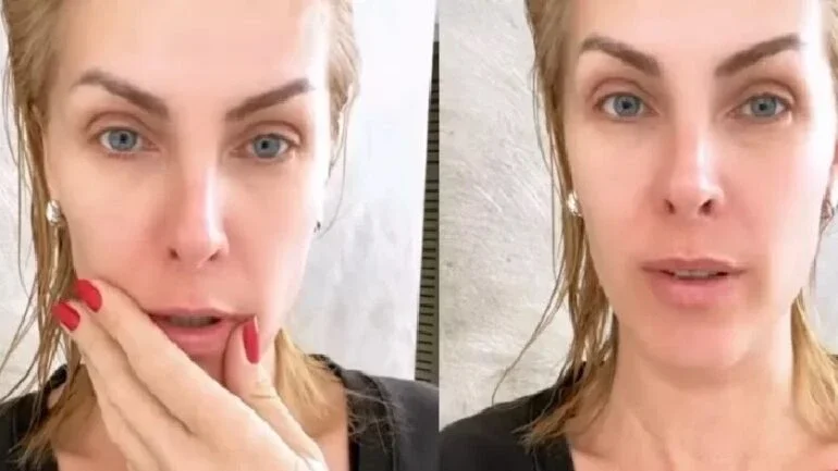 Ana Hickmann relata susto após vidro do box do banheiro estourar sobre ela