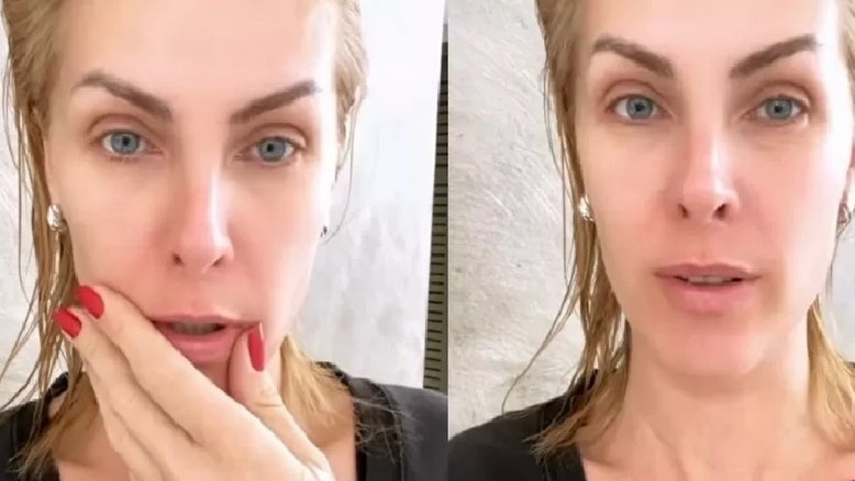 Ana Hickmann relata susto após vidro do box do banheiro estourar sobre ela