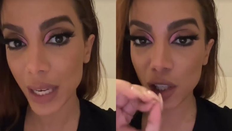 Anitta sobre ser alvo de fake news envolvendo HIV: 'Não é xingamento'