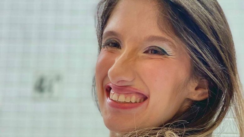 Influenciadora Belly Palma morre, aos 29 anos, após engasgo e parada cardiorrespiratória