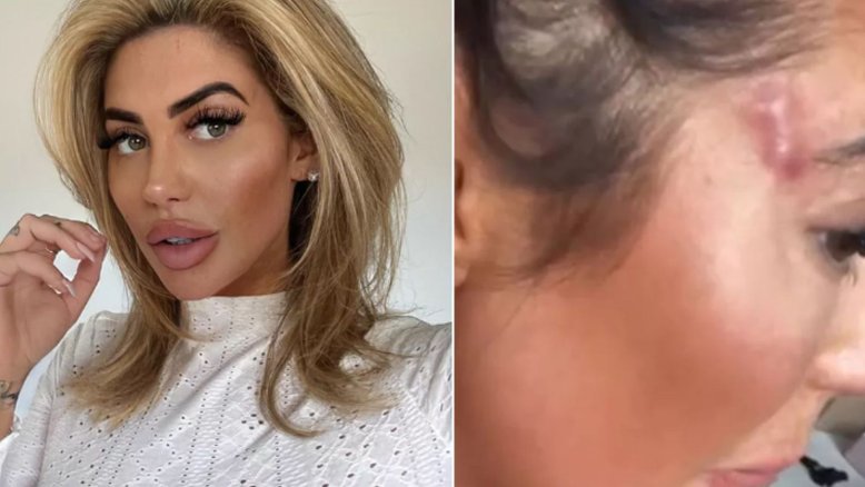 Chloe Ferry