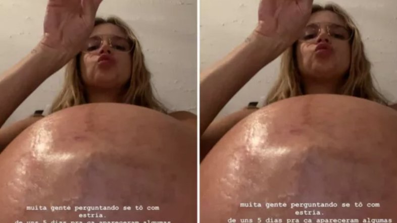 Isa Scherer mostra estrias da gravidez