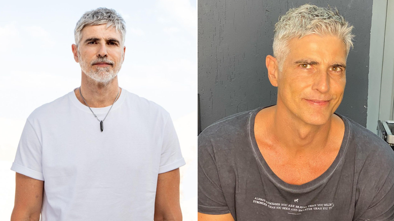 Aos 49 anos, Reynaldo Gianecchini faz rejuvenescimento facial; veja resultado