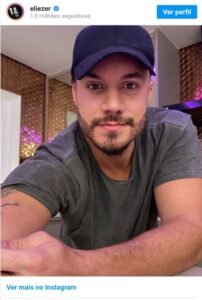 Eliezer mostra resultado de implante de barba