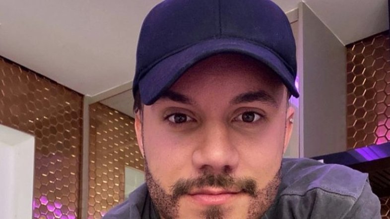 Eliezer mostra resultado de implante de barba
