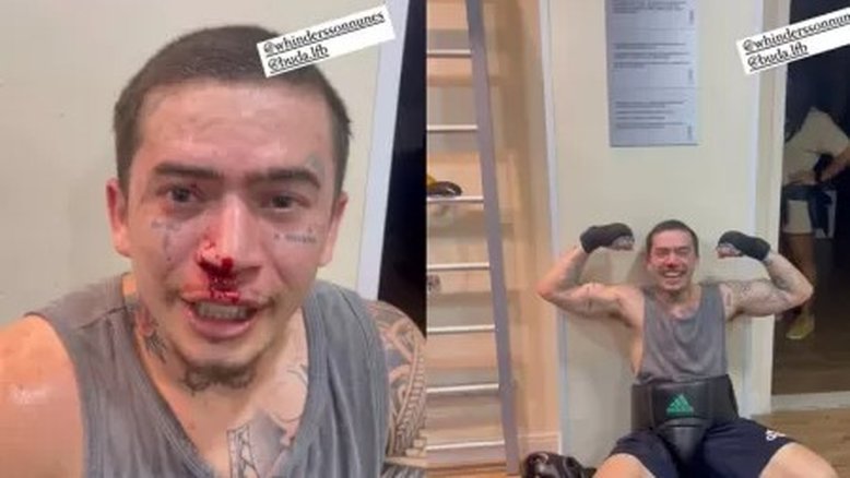 Whindersson surge machucado após treino de luta: 'Mexi com o cara errado'