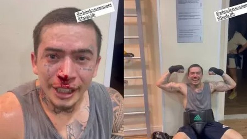 Whindersson surge machucado após treino de luta: 'Mexi com o cara errado'