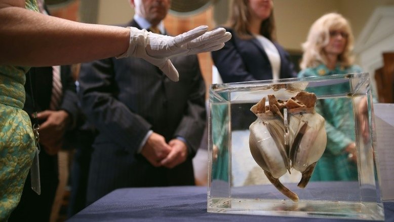 Morre o cirurgião argentino Domingo Liotta, pioneiro do coração artificial
