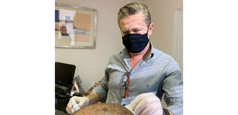 Referência em transplante, dr. Giovany bettega fala sobre técnica que deixa cabelo com aspecto natural