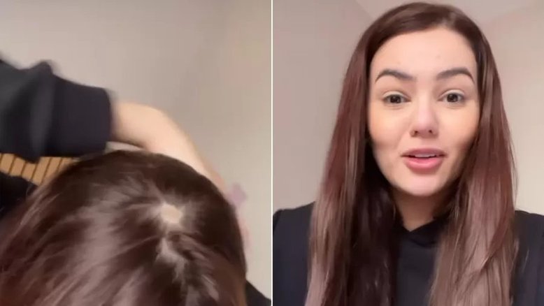 ‘É bizarro’: Entenda a doença que atingiu a ex-BBB Eslovênia