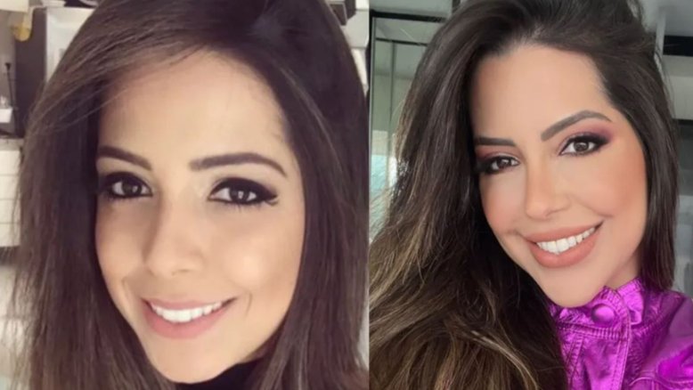 Antes e depois de Laís Caldas