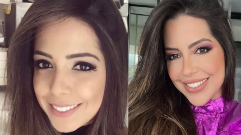 Antes e depois de Laís Caldas