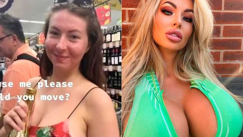 Modelo do Onlyfans surpreende com antes e depois de plásticas
