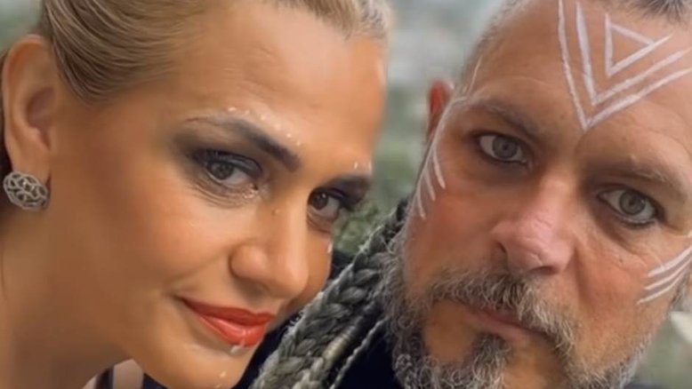 O que é Mal de Perthes, a doença que atingiu o ex-galã da Globo Luigi Baricelli: 'Vale da dor'
