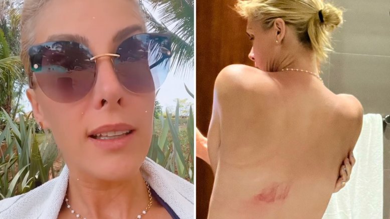 Ana Hickmann