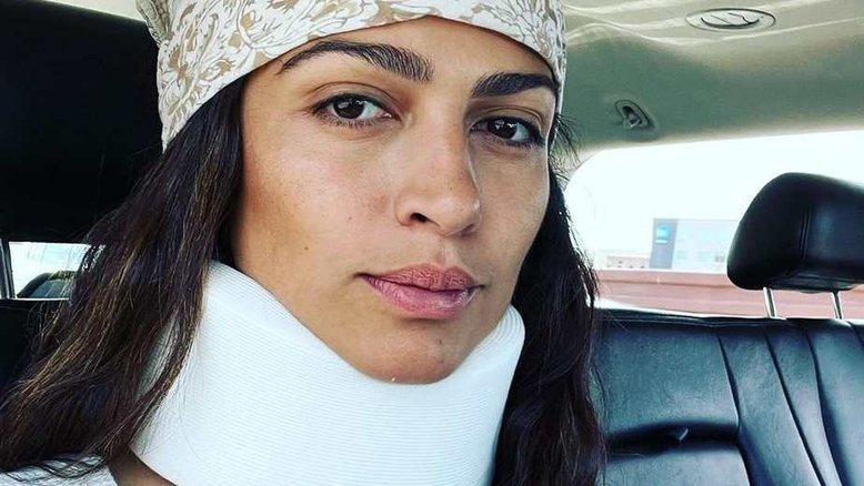 Brasileira casada com Matthew McConaughey choca fãs após 'acidente bobo'