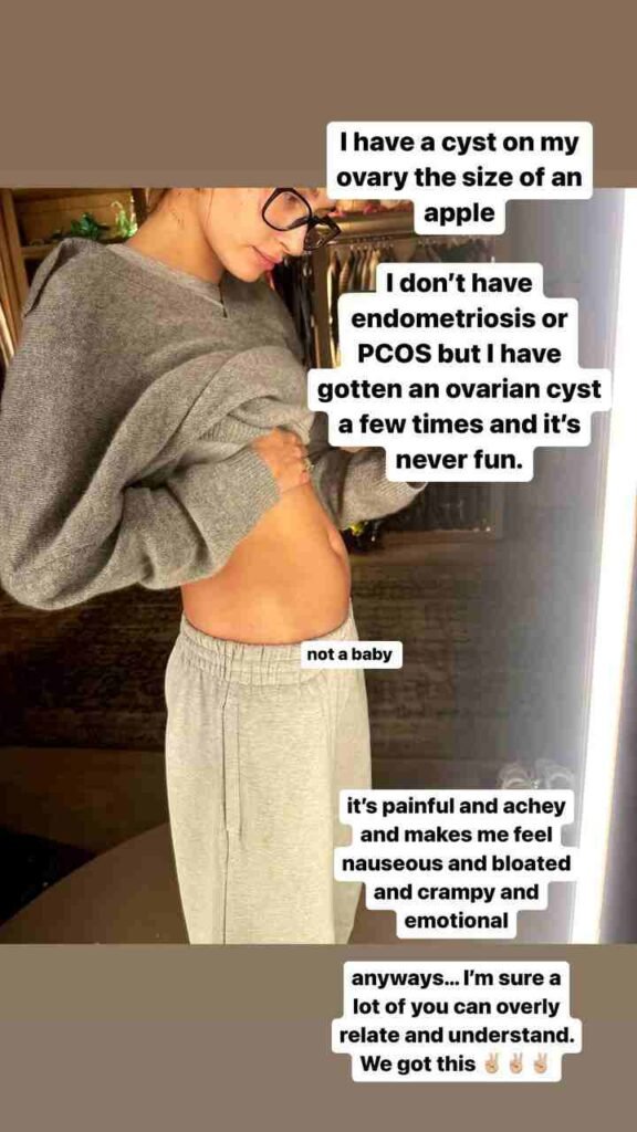 Hailey Bieber diz ter cisto no ovário e mostra barriga inchada: 'Não é um bebê' 4 Hailey Bieber diz ter cisto no ovário e mostra barriga inchada: 'Não é um bebê'