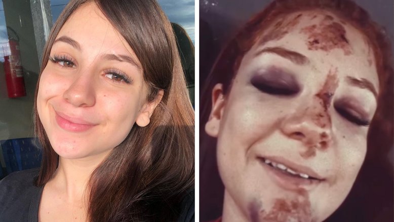 Jovem atropela onça pintada e fica com o rosto desfigurado após capacete soltar