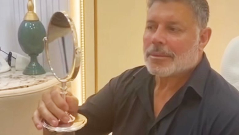 Antes e depois: Nariz de Alexandre Frota fica arrebitado após harmonização facial