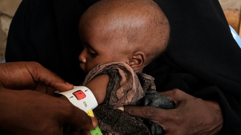 ONU alerta para mortalidade infantil 'alarmante' no mundo
