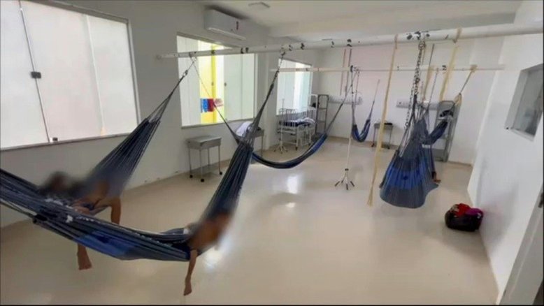 Crianças Yanomami desnutridas convalescem em hospital de Roraima