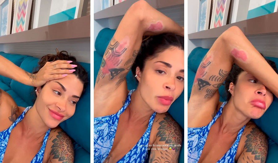 VÍDEO: Aline Campos mostra cicatrizes de acidente na Indonésia 2 Aline Campos. Foto: Reprodução Instagram