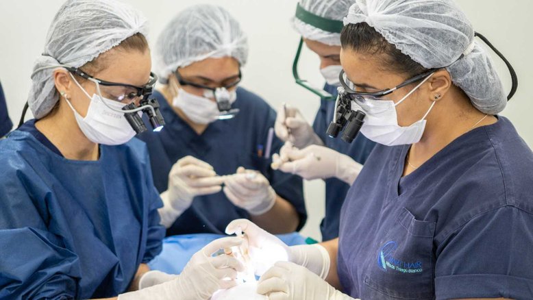 transplante capilar