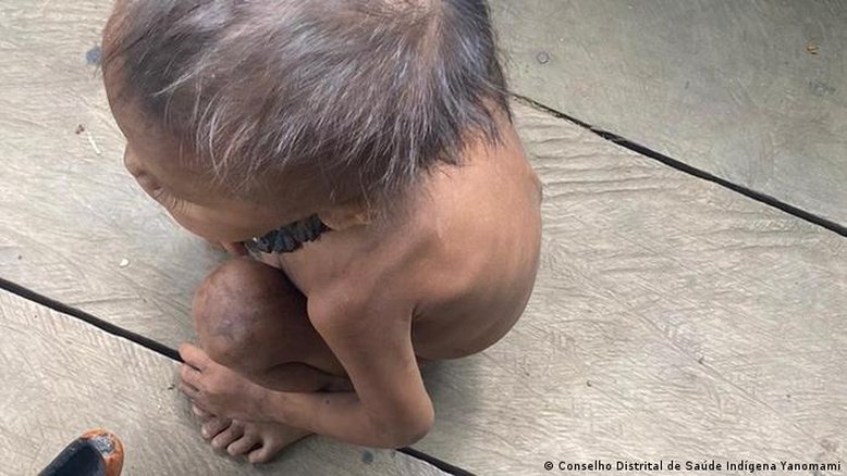 Mortalidade de bebês yanomami é 10 vezes maior que a do Brasil