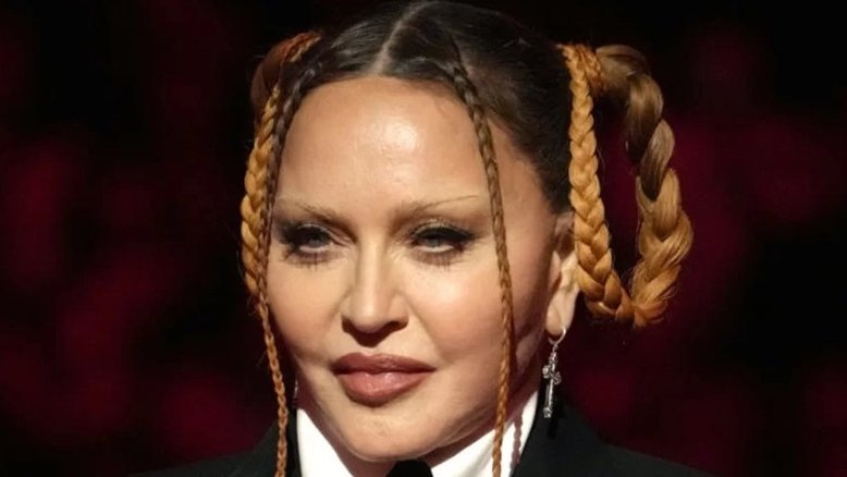 Um ano antes de se apresentar no Brasil, Madonna teve rosto deformado e grave problema de saúde