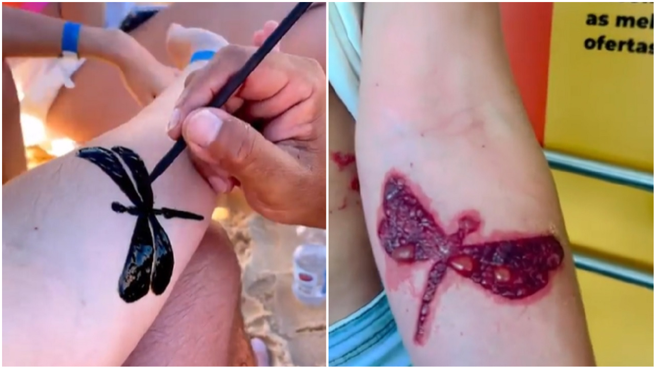 Especialista alerta sobre os riscos da tatuagem de henna