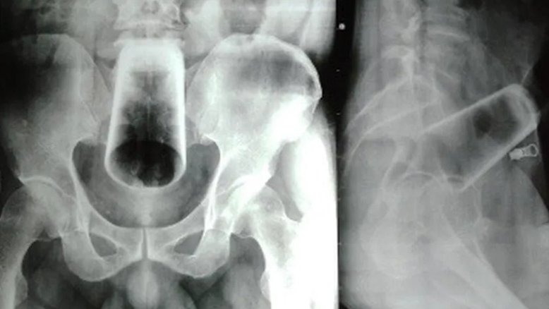 Reprodução/Journal of the Nepal Medical Association