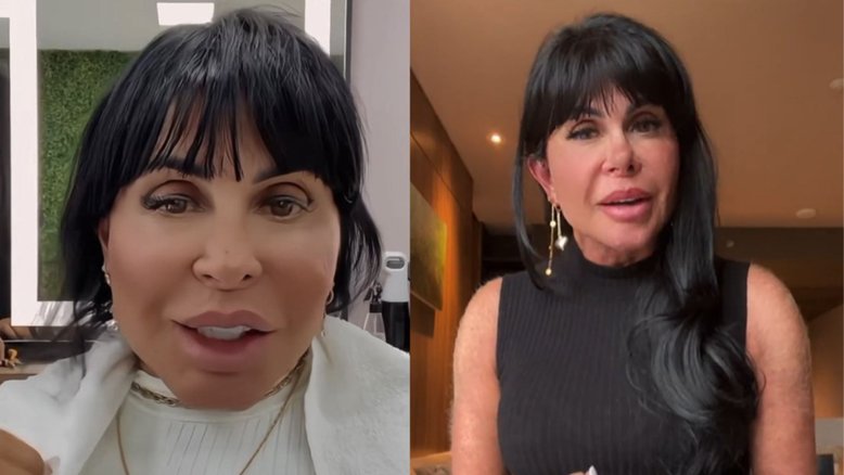 Após rumores de nova harmonização facial, Gretchen se defende: 'Meu rosto não está deformado'