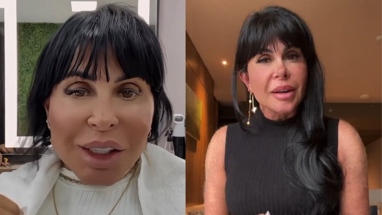 Após rumores de nova harmonização facial, Gretchen se defende: 'Meu rosto não está deformado'
