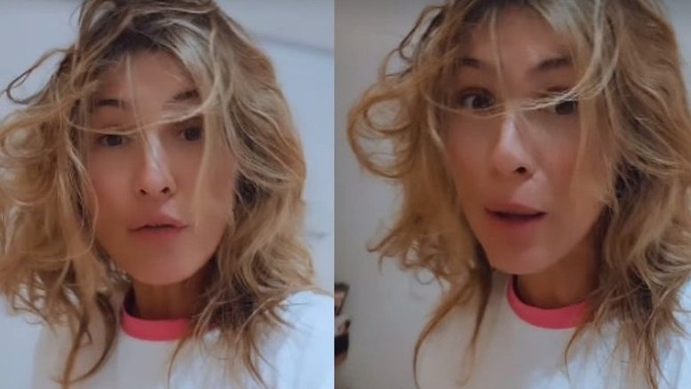 Lívia Andrade quebra dente e sofre com infestação de pulgas: 'Até fogo taquei em mim'