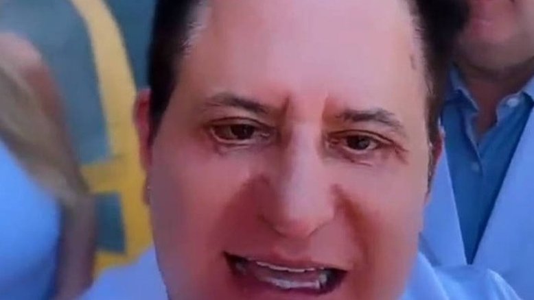 Ataque de pânico, detonado na web e mais: tudo sobre a cirurgia facial de Marrone