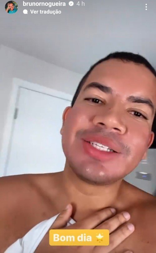 Após desisitir do BBB23, Bruno passa por harmonização facial: 'Tinha vergonha de postar foto'