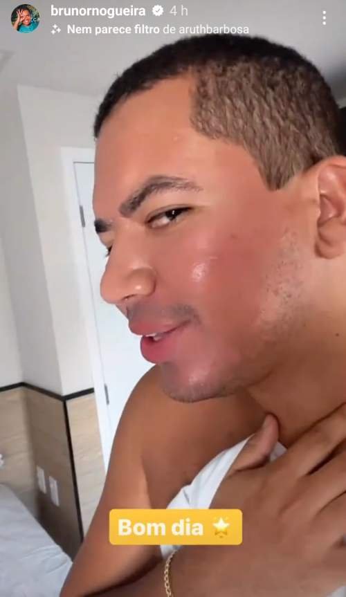 Após desisitir do BBB23, Bruno passa por harmonização facial: 'Tinha vergonha de postar foto'