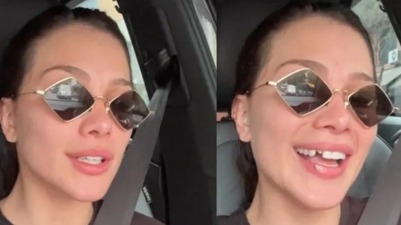 Dentista faz alerta após influenciadora Flavia Pavanelli ficar banguela por causa de lentes de contato