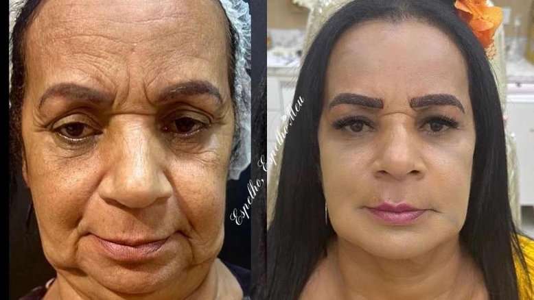 'Passa contato pro Marrone': Ex-Pânico faz harmonização facial e web reage