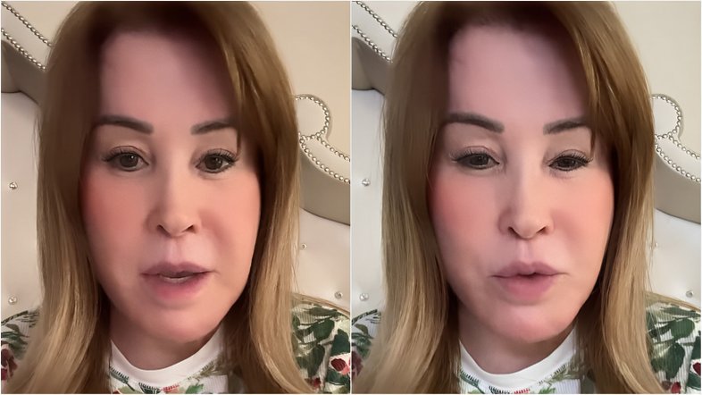 Zilu Godoi se submete a cirurgia na gengiva e nega botox após receber críticas