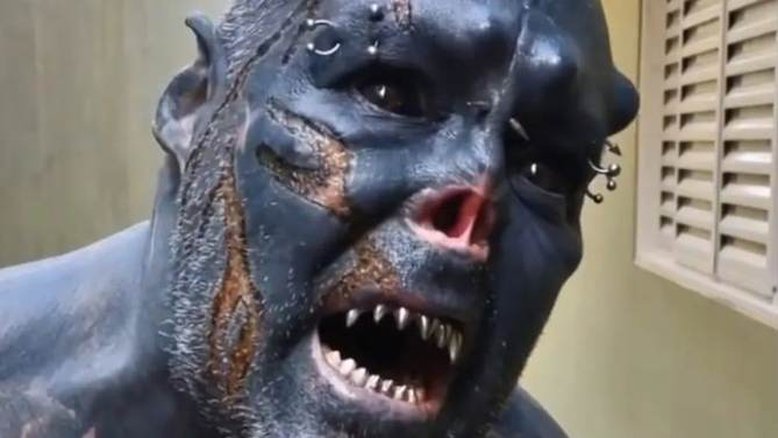 ‘Dor extrema’, diz homem após queimar a pele para nova modificação corporal