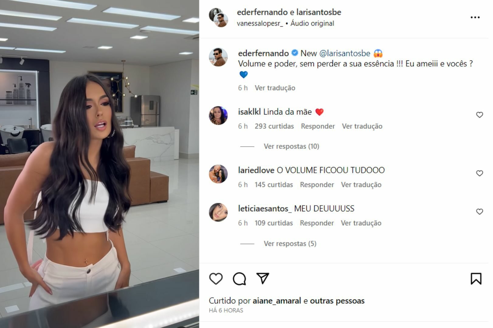 Ex-BBB Larissa troca lentes de contato e mostra novo sorriso: 'Me incomodava' 16 Ex-BBB Larissa troca lentes de contato e mostra novo sorriso: 'Me incomodava'