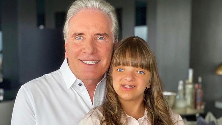 Antes de fazer cirurgia plástica aos 14 anos, Rafa Justus já corrigiu estenose crânio-facial