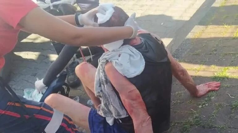Homem tem olho perfurado por vizinho que invadiu apartamento pelado