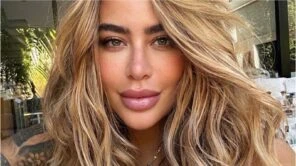 Criticada por uso de photoshop em fotos, especialista fala sobre procedimentos estéticos de Rafaella Santos
