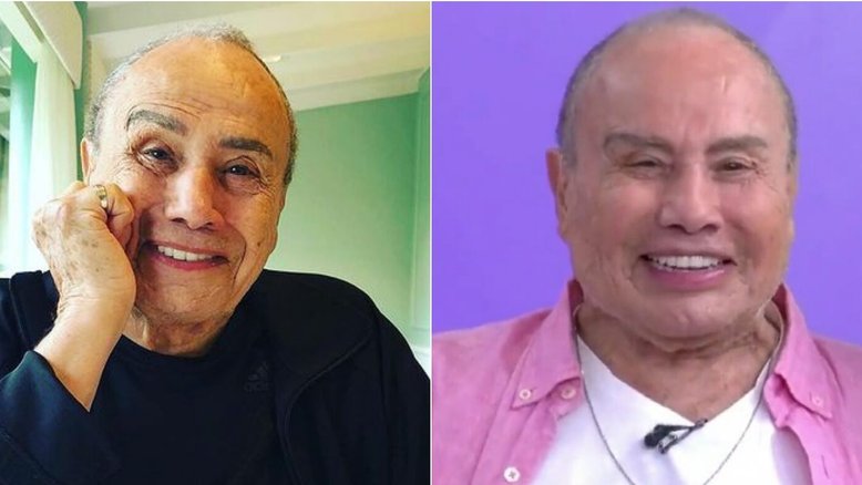 Retrospectiva 2023: veja os famosos que fizeram harmonização facial